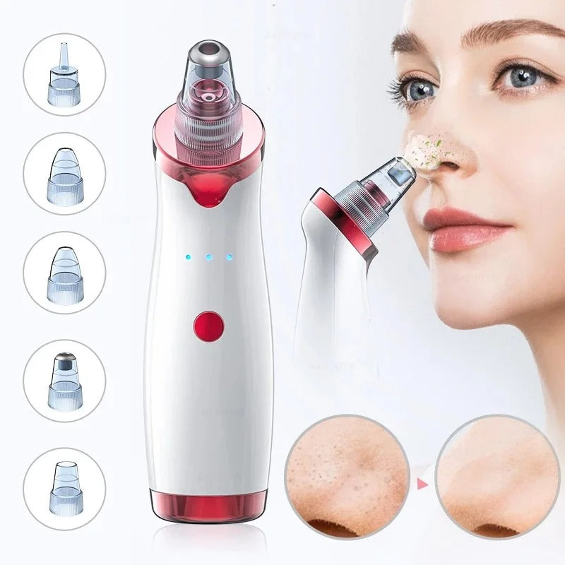 Extractor de puntos negros & acne