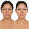Suero Reafirmante NAD+ EGF