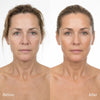 Suero Reafirmante NAD+ EGF